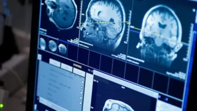 كبسولات صغيرة تحد من التهاب الدماغ كبسولات صغيرة تحد من التهاب الدماغ