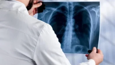 دراسة تربط أظافر القدم بسرطان الرئة