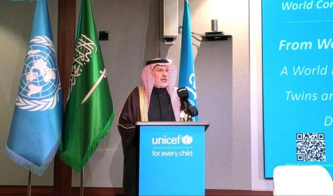 الربيعة: حريصون على الاندماج المجتمعي للتوائم الملتصقة