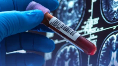 اكتشاف فصيلة دم نادرة لدى 3 أشخاص فقط