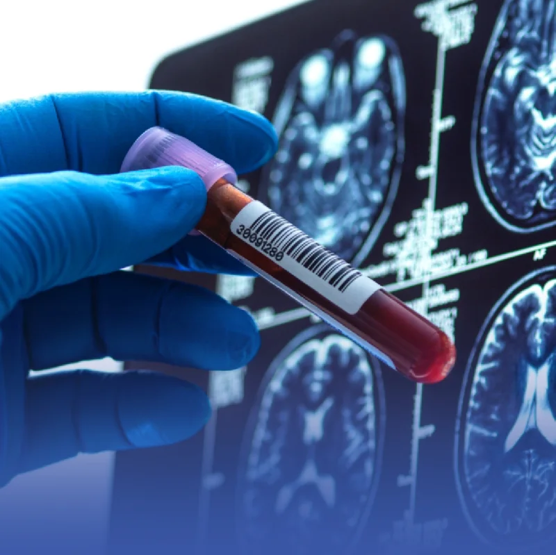 اكتشاف فصيلة دم نادرة لدى 3 أشخاص فقط اكتشاف فصيلة دم نادرة لدى 3 أشخاص فقط