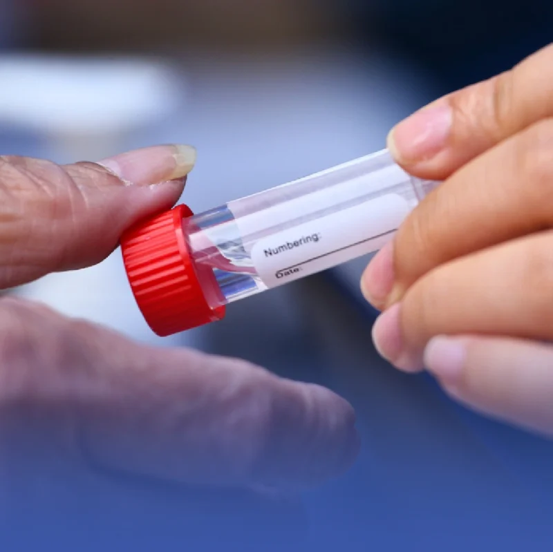 اختبار اللعاب يكشف أمراض القلب بشكل أسرع