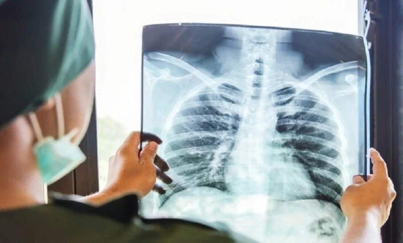 السُعال الديكي.. أعراضه وعلاجه والفئات الأكثر عُرضة له